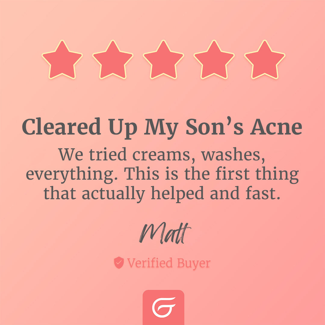 GlowUp™ Acne Wand